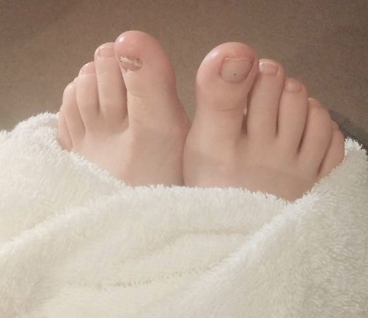 Photograph of foot massage
